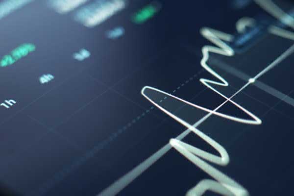 石油资源丰富的委内瑞拉马杜罗政权倒台 短期内难撼能源市场